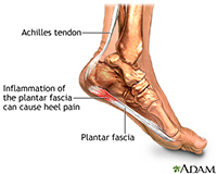 Hip Fracture Treatment | Ankle Sprain Treatment | Reisterstown MD | Owings Mills MD